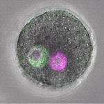 　父方のゲノム（緑色）と母方のゲノム（紫色）が二つの前核に分かれている通常の受精卵（上）と父方と母方のゲノムを人工的に一つの前核にまとめた受精卵の顕微鏡画像（理化学研究所提供）
