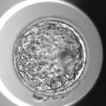 　塩基編集でＮＡＮＯＧ遺伝子を改変した人の受精卵（ケンブリッジ大ローク栄養胚葉研究センター提供）