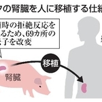 　ブタの腎臓を人に移植する仕組み