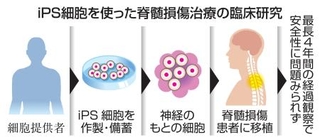 　ｉＰＳ細胞を使った脊髄損傷治療の臨床研究