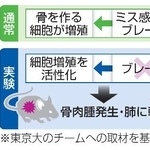　骨肉腫の発症メカニズム研究（イメージ）
