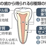 　１本の歯から得られる６種類の情報