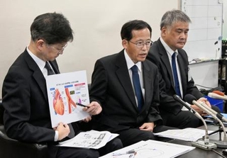 　医療事故について説明する鳥取県立中央病院の千酌浩樹病院長（中央）ら＝１日午後、鳥取市