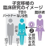 　子宮移植の臨床研究のイメージ