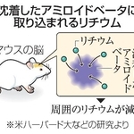 　沈着したアミロイドベータに取り込まれるリチウム