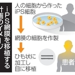 　ｉＰＳ網膜を移植する計画のイメージ