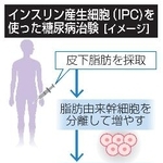 　インスリン産生細胞（ＩＰＣ）を使った糖尿病治験（イメージ）