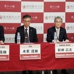 　記者会見をする関西医大病院新薬開発科の清水俊雄教授（左端）＝１１日、大阪府枚方市