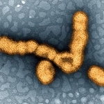 　インフルエンザウイルスの電子顕微鏡写真（米国立アレルギー感染症研究所提供）