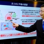 　慢性炎症について説明する千葉大の平原潔教授＝１０日、東京都千代田区