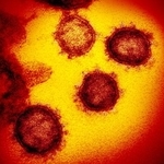 　新型コロナウイルスの電子顕微鏡写真（米国立アレルギー感染症研究所提供）