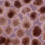 　ｉＰＳ細胞で作った心臓の筋肉の細胞を塊にした「心筋球」（ハートシード提供）