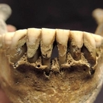 　ウクライナから出土した中世人骨の歯石（オレクサンドラ・コザク博士提供）