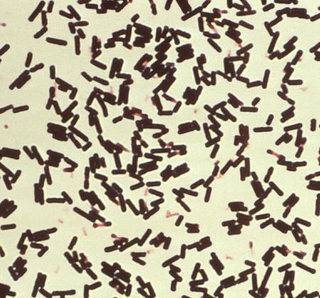 　ウエルシュ菌の顕微鏡写真（米疾病対策センター提供）