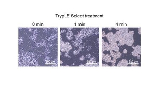 　酵素処理により細胞間の結合が弱まる様子（左から右へ）を示すｉＰＳ細胞の顕微鏡画像（（Ｃ）２０２５　Ｅｌｓｅｖｉｅｒ　Ｂ．Ｖ．　Ａｌｌ　ｒｉｇｈｔｓ　ａｒｅ　ｒｅｓｅｒｖｅｄ，　ｉｎｃｌｕｄｉｎｇ　ｔｈｏｓｅ　ｆｏｒ　ｔｅｘｔ　ａｎｄ　ｄａｔａ　ｍｉｎｉｎｇ，　ＡＩ　ｔｒａｉｎｉｎｇ，　ａｎｄ　ｓｉｍｉｌａｒ　ｔｅｃｈｎｏｌｏｇｉｅｓ．）