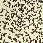 　ウエルシュ菌の顕微鏡写真（米疾病対策センター提供）