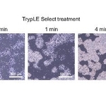 　酵素処理により細胞間の結合が弱まる様子（左から右へ）を示すｉＰＳ細胞の顕微鏡画像（（Ｃ）２０２５　Ｅｌｓｅｖｉｅｒ　Ｂ．Ｖ．　Ａｌｌ　ｒｉｇｈｔｓ　ａｒｅ　ｒｅｓｅｒｖｅｄ，　ｉｎｃｌｕｄｉｎｇ　ｔｈｏｓｅ　ｆｏｒ　ｔｅｘｔ　ａｎｄ　ｄａｔａ　ｍｉｎｉｎｇ，　ＡＩ　ｔｒａｉｎｉｎｇ，　ａｎｄ　ｓｉｍｉｌａｒ　ｔｅｃｈｎｏｌｏｇｉｅｓ．）