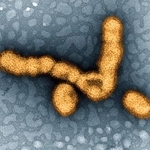 　インフルエンザウイルスの電子顕微鏡写真（米国立アレルギー感染症研究所提供）