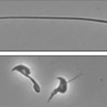 　マウスの精子の顕微鏡画像。タンパク質「ＣＦＡＰ９１」を作る遺伝子を欠損させた精子（下）は、べん毛の形成がうまくいかず泳げなくなった