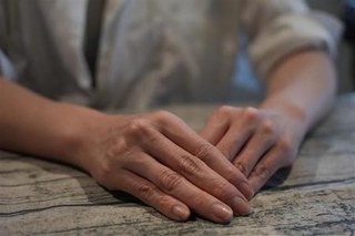 取材に応じる減胎手術を受けた女性＝７月、大阪府