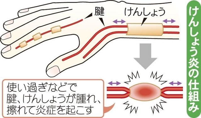 神戸新聞ＮＥＸＴ