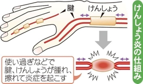 神戸新聞ＮＥＸＴ