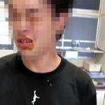 目や唇に激辛カレーを塗られた男性教員（提供写真、画像の一部を加工しています）
