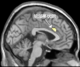 筆者が実施したｆＭＲＩ実験で確認した社会的痛みに関わる脳領域