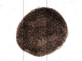 ｉＰＳ細胞から作られた網膜色素上皮細胞のシート。患者の目に移植された（理化学研究所／先端医療振興財団提供）