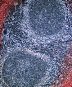 臨床研究１例目の患者の皮膚から作られたｉＰＳ細胞（理化学研究所／先端医療振興財団提供）