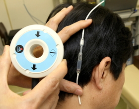 頭部に埋め込まれる管（右）には、髄液の量を調整するバルブが付いている。体外から磁石を使った器具で動かす＝兵庫県尼崎市東大物町１（撮影・佐々木彰尚）