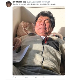 足の爪を切ってもらう為に寝転んだら、顔に直射日光が当たって悶絶する赤井英和さん