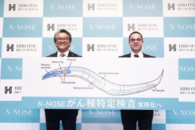尿を採取するだけで早期すい臓がんを調べることが可能になったと発表するHIROTSUバイオサイエンスの広津崇亮代表取締役社長（左）と同社湘南R＆Dセンターのエリック・デルクシオセンター長