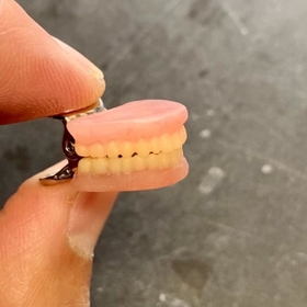 （タイデンタルラボさん提供）