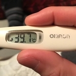 発症から2日目。熱は39.7度に達した