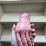 大きさ、肌の質感、血管の青み…本物にしか見えない（画像提供：ピエロ大好き人間さん）