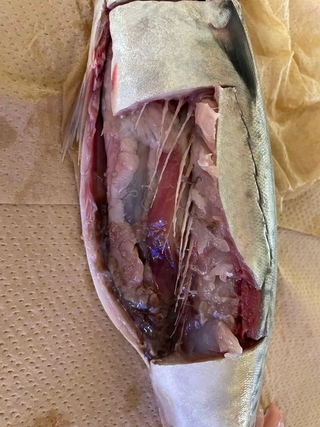 肉眼ではなかなか見分けがつかないアニサキス（宮崎大学医学部寄生虫学提供）