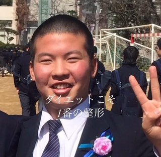 98キロあった15歳の時の元野球部員。ここから40キロ痩せると…（いずれも小松田卓宏さん提供）