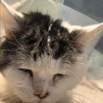 経鼻チューブで栄養を補給