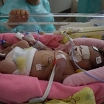 生後1日目（低体温療法中）「麻痺や障害が出る可能性がある」と宣告された娘／ミコフォトさん（@mi.ko.photo）提供