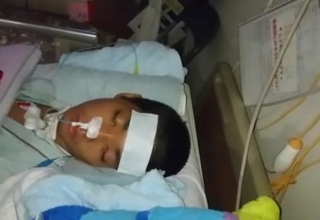 深い意識障害の状態となり、気管切開後の樹希さん。搬送時、顔は本来の形が分からないほど腫れ上がっていた