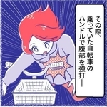 バイクとぶつかった際にハンドルで腹部を強打（桜木きぬさん提供）