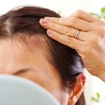 知らない他人の薄毛が気になったことはありますか？　※画像はイメージです（琢也 栂/stock.adobe.com）