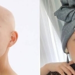 脱毛に悩むがん患者に「おしゃれターバン」という選択肢　「ストレスを軽減し回復促進につながってほしい」