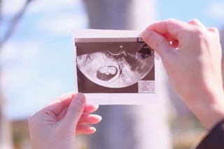 障害のある家族とともに生きてきた妊娠中の女性がつぶやいた投稿が話題に（photoACより「りんどる」さん撮影、イメージ画像）