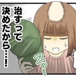 抜毛症を治したい！（春乃おはなさん提供）