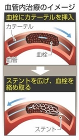 神戸新聞ＮＥＸＴ