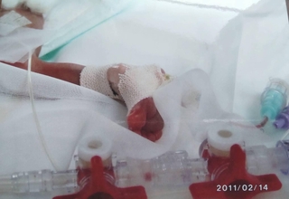 NICUでの息子